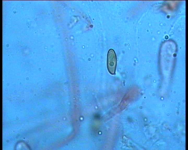 Winkel   ( FRA )   28.08.2004    1 Serie